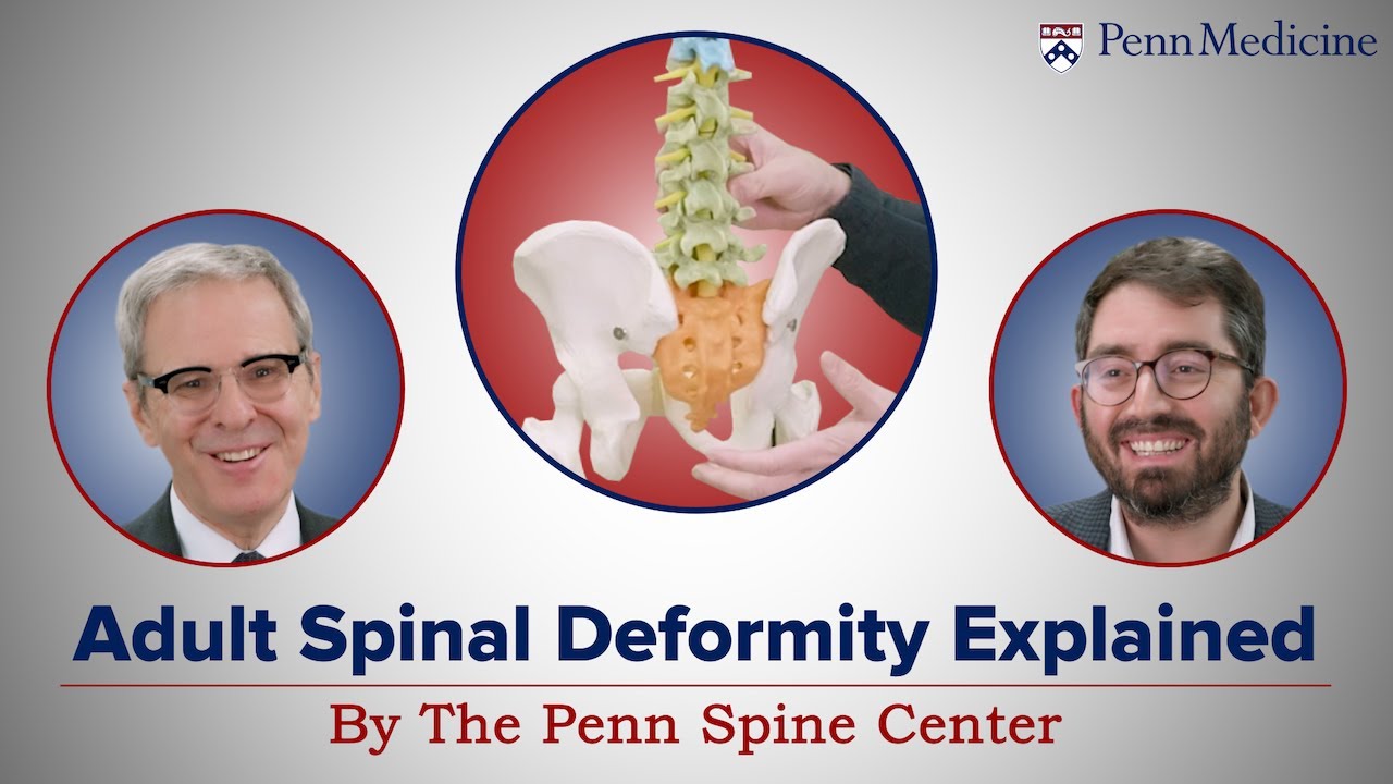 Watch video titled Penn Spine Center: Adult Spinal Deformity on YouTube