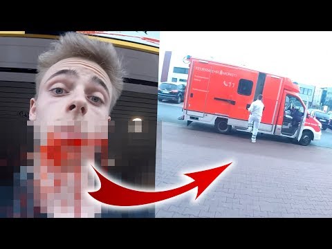 FAIL! Unfall.. Krankenwagen muss kommen 😩