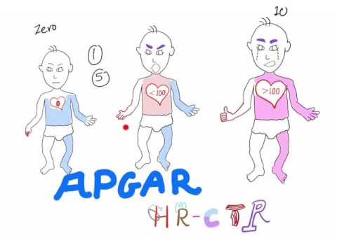 APGAR score - with a mnemonic! - Pediatrics