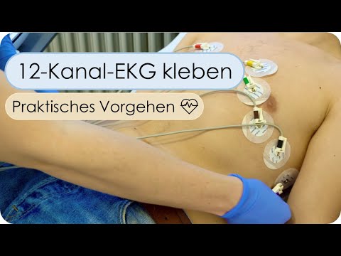 Anlage eines 12-Kanal-EKG (Skills, EKG kleben, EKG-Elektroden, Reihenfolge, EKG-Auswertung)