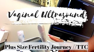 MORE RESULTS Vaginal Ultrasound // Plus Size Fertility Journey // TTC