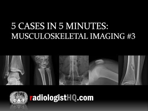 5 Cases in 5 Minutes: Musculoskeletal #3