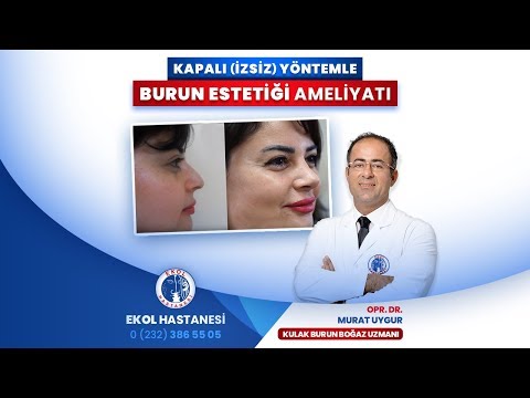 Kapalı (İzsiz) Yöntemle Burun Estetiği - Opr. Dr. Murat Uygur - İzmir Ekol Hastanesi