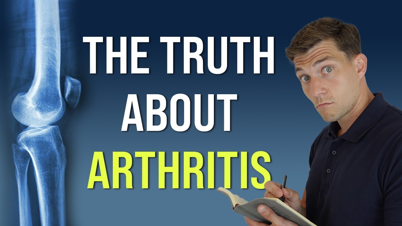 5 Things Your Doctor Never Told You About Arthritis