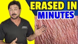 Simple Way To Smooth Out Wrinkly Skin In 2 Minutes