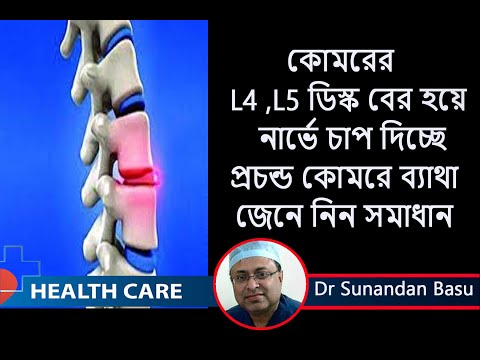 L4 L5 disc bulge treatment || মেরুদণ্ডে L1,L5   এ ব্যাথার কারণ ও তার চিকিৎসা || Dr. Sunandan Basu