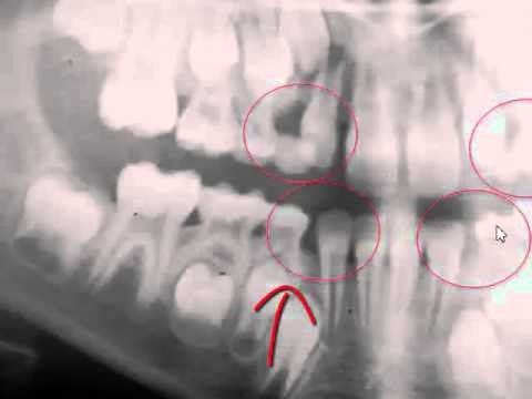 interceptive orthodontics part 1 1