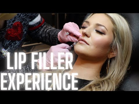 FIRST TIME GETTING LIP FILLER || LIVE EXPERIENCE! || **1/2 SYRINGE**