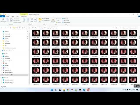 Esophageal Fusion Image Classification CNN Flask App in Python Projects