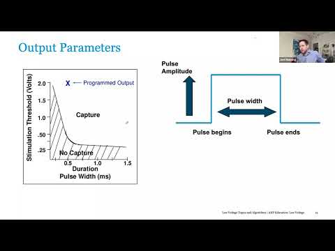 Pacemaker Electrical Concepts & Basic Timing Cycles - Port Harcourt Pacing