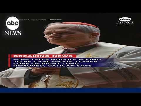 Pope Leo's nodule found to be cancerous, lower lobe of right lung removed, Vatican says