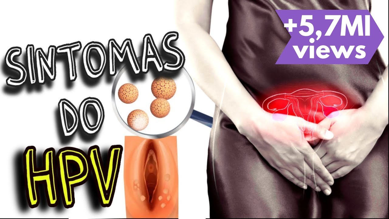 Sintomas do HPV - Papiloma Vírus Humano- doença perigosa e silenciosa