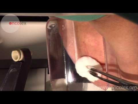 Stereotactic-guided core biopsy