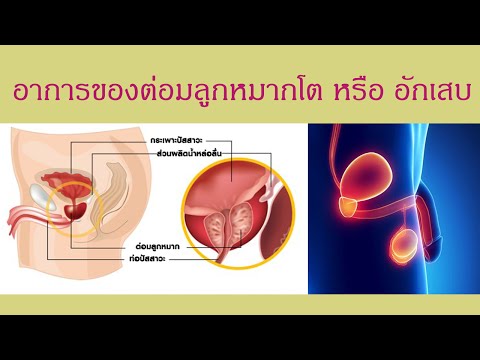 การปลูกถ่ายอวัยวะเพศชาย อาหารเพิ่มความแรง
