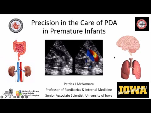 Why Early Detection of PDA is Crucial