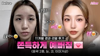 쫀득하게 예뻐짐🩷｜리얼후기