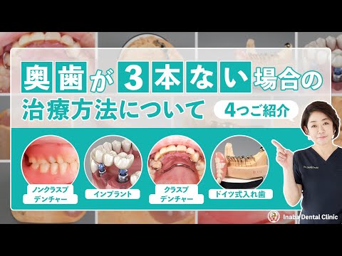 奥歯が3本ない場合の治療方法について4つご紹介