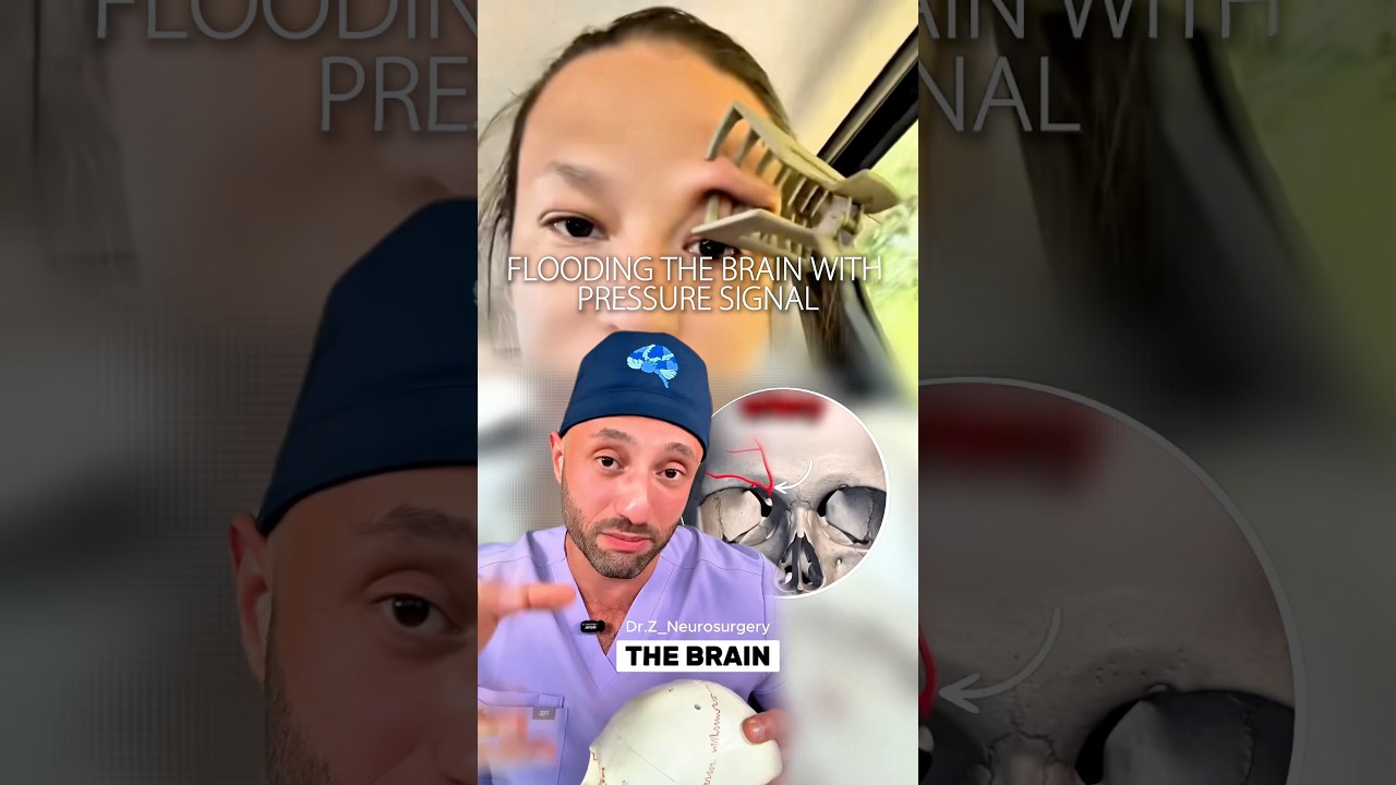 Migraine life hack?! 👀  #migraine #headache #science #medical #doctor