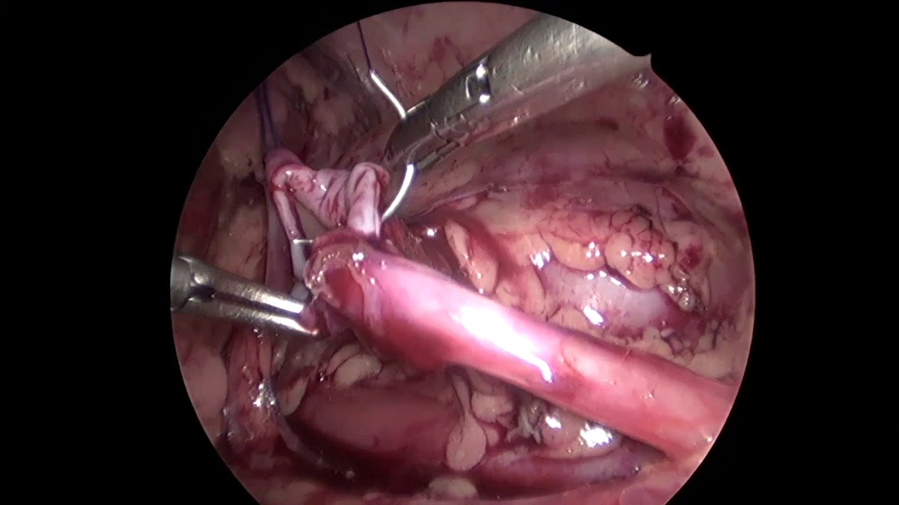 Daniel Cabezali Barbancho-24