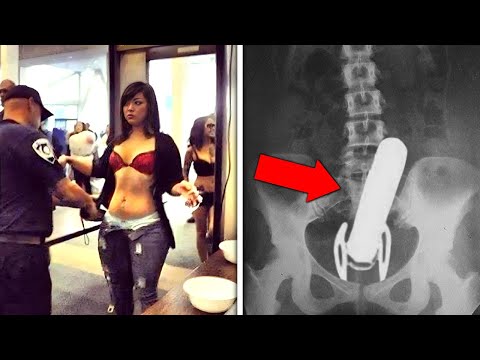 20 Strange Things Discovered By X Rays