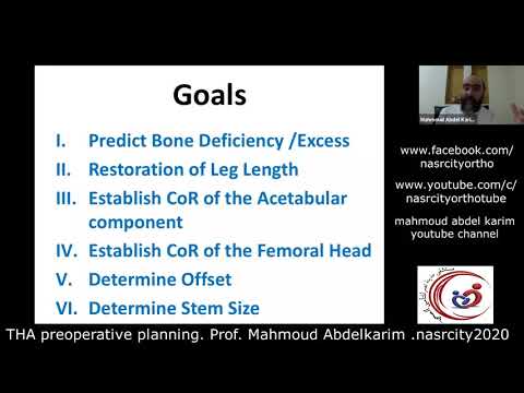 THA preoperative planning.Prof. Mahmoud Abdelkarim. nasrcity covid19 time online lectures