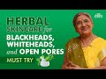 How To Get Rid of Blackheads, Whiteheads, and Open Pores Naturally | Natural Skincare Remedies