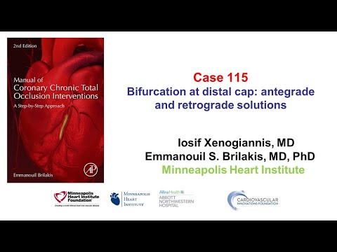 Case 115: Manual of CTO Interventions - Bifurcation at distal cap and retrograde crossing