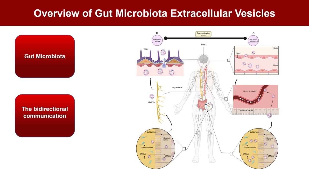 Gut microbiota extracellular vesicle in neurodegenerative disorders and therapeutic management