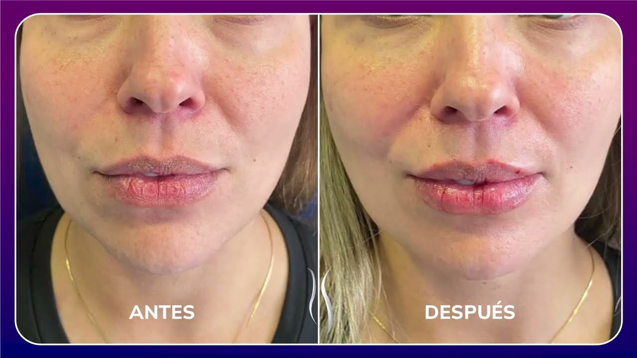 Alexander Mendoza-125