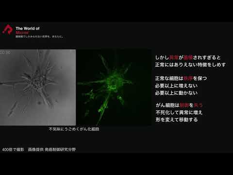 The World of Micros’ -がん細胞編-