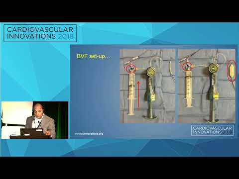 CVI2018 Session: Try this at home, this way - Adnan Chattrawalla, MD