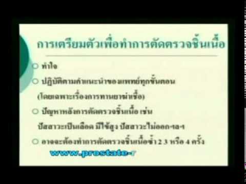 Truths และตำนานเกี่ยวกับ Exciter ม้า ความดันโลหิตและความอ่อนแอ