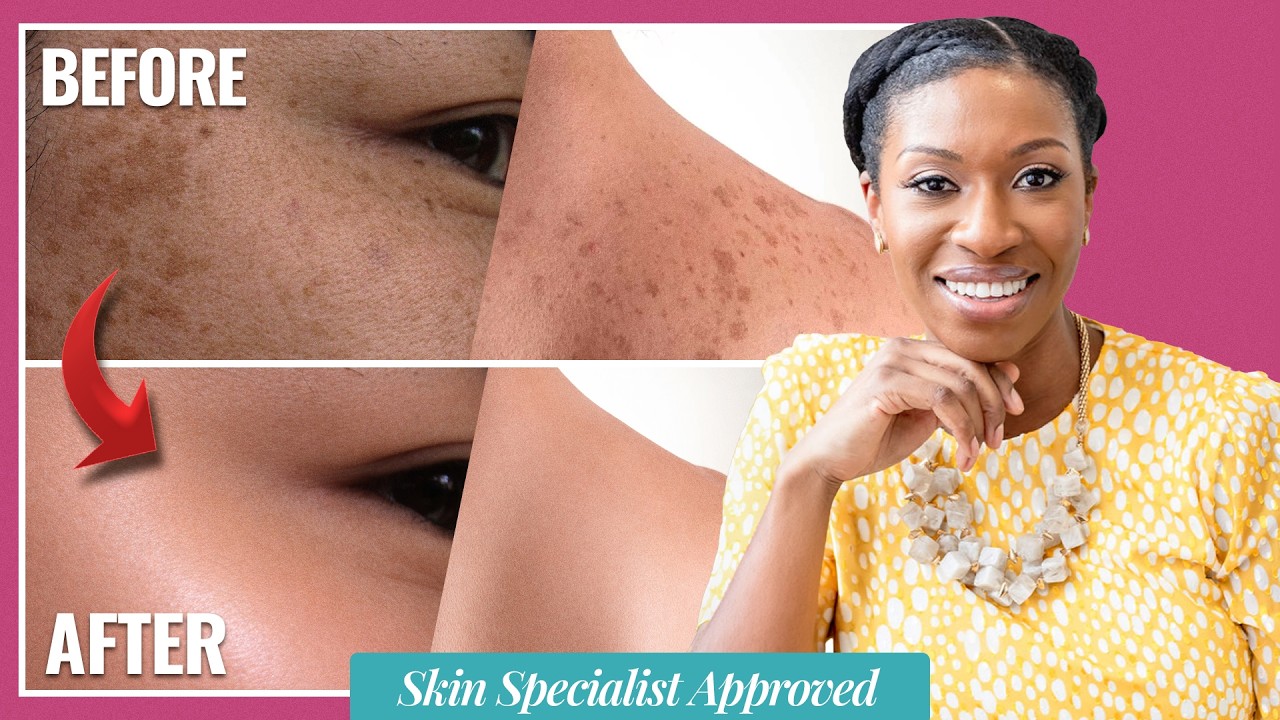 Best Treatments & Products for Fading Hyperpigmentation (Body + Face)