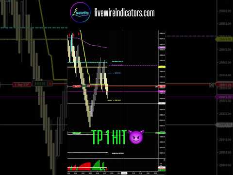 How I manage NQ Trades