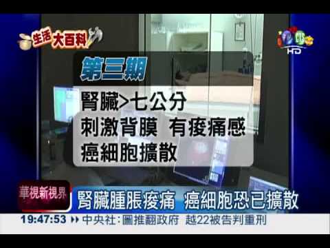 當心腎臟癌! 易併發導致死亡