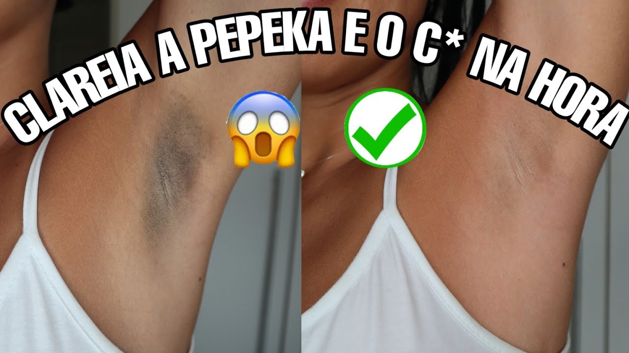 USE PARA CLAREAR AXILA E VIRILHA EM 5 MINUTOS RECEITA CASEIRA!