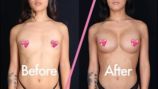 Gia Gunn Transition Surgery | Dr. Leif Rogers | Mini Documentary