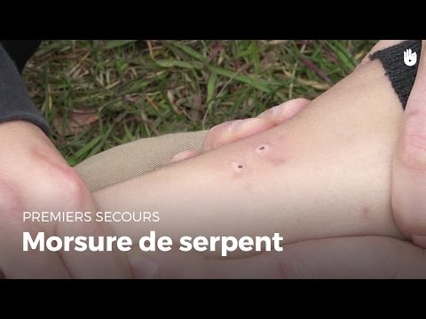 First Aid: Snake Bite | First Aid