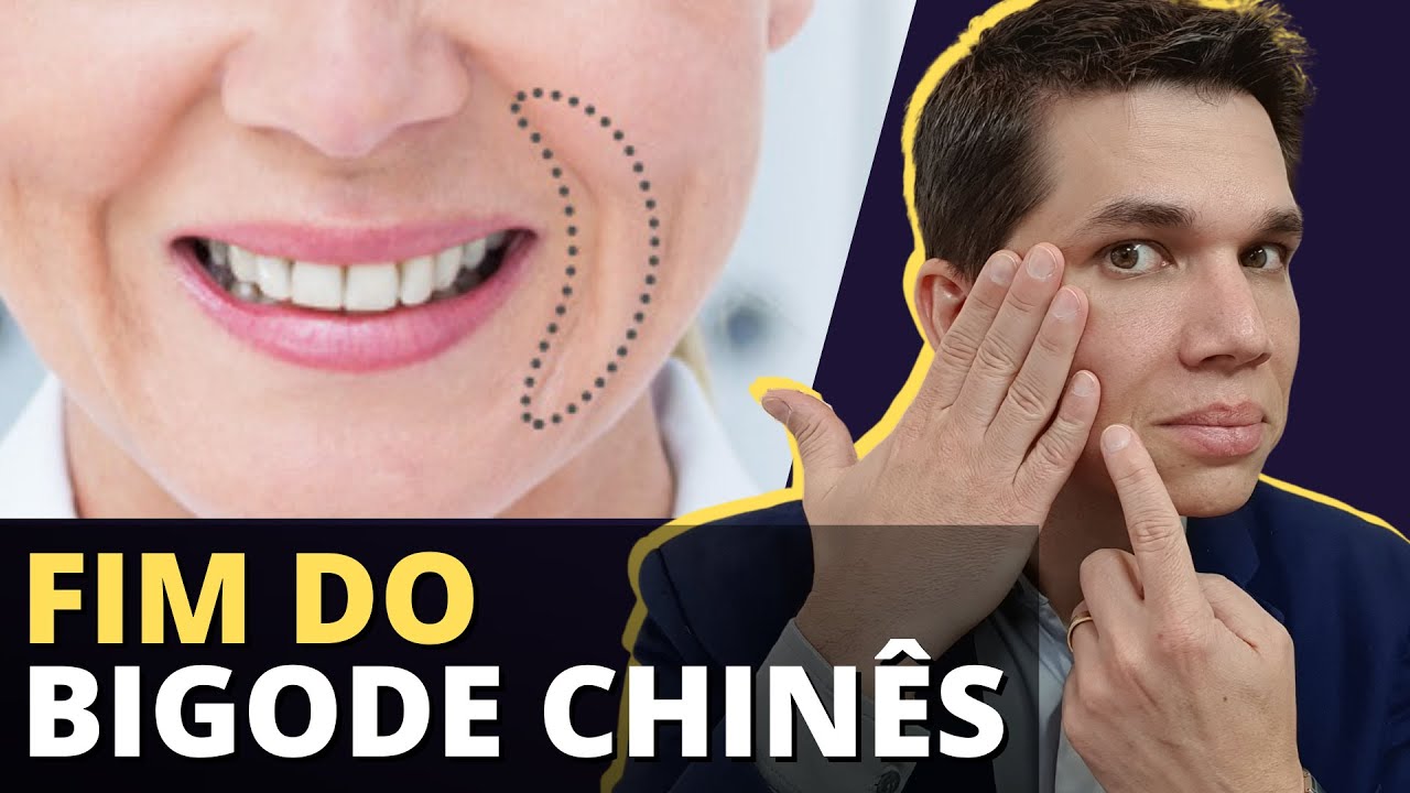 FIM DO BIGODE CHINÊS: Como tratar e acabar DEFINITIVAMENTE com essa Ruga?