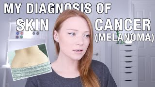 I was Diagnosed with Skin Cancer. (Melanoma)