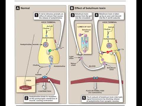 Bacteriology 8: Anaerobic Gram positive e.g Clostridium and negative Rods e.g. Bacteriodes