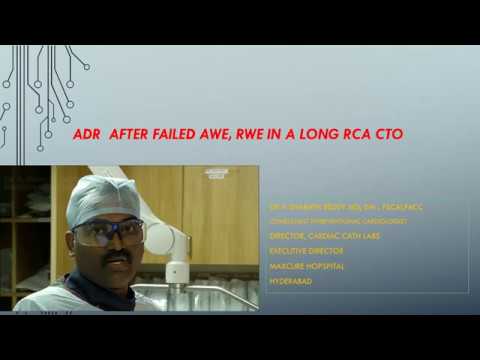Decoding CTO Case-6: ADR after failed AWE & RWE by Dr. Sharath Reddy