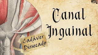 Canal Inguinal (no cadáver) | Prof. Eduardo Beber - Anatomia/UFES