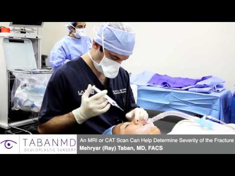 Orbital Blowout Fracture Surgery Orbital Blowout Fracture Surgery