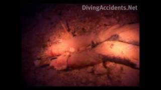 Dead Scuba Diver in the Blue Hole, Diving Accidents