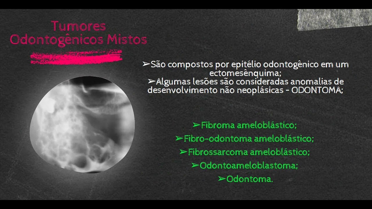 Tumores Odontogênicos (Parte 1)