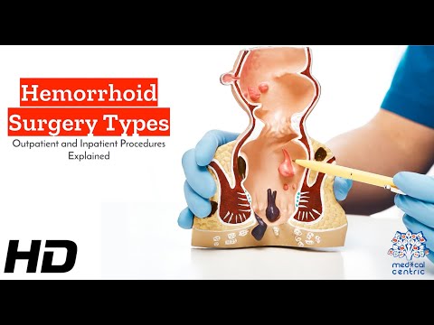 Effects of Cannabis on your body