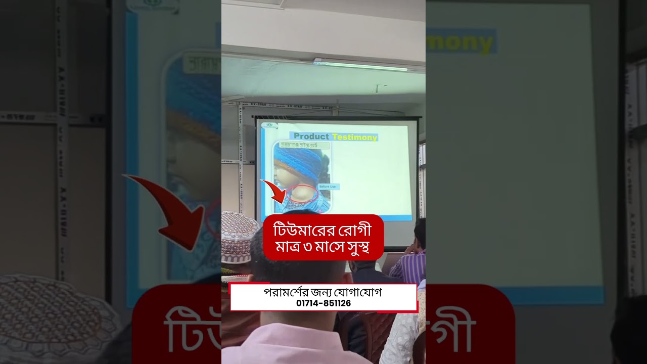 টিউমারের রোগীর সুস্থ মাত্র ৩ মাসে