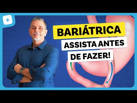 Cirurgia Bariátrica: melhor solução para emagrecer?