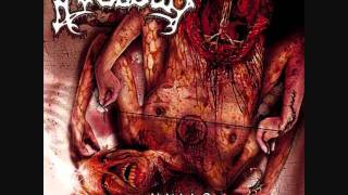 avulsed-Amidst The Macabre.wmv